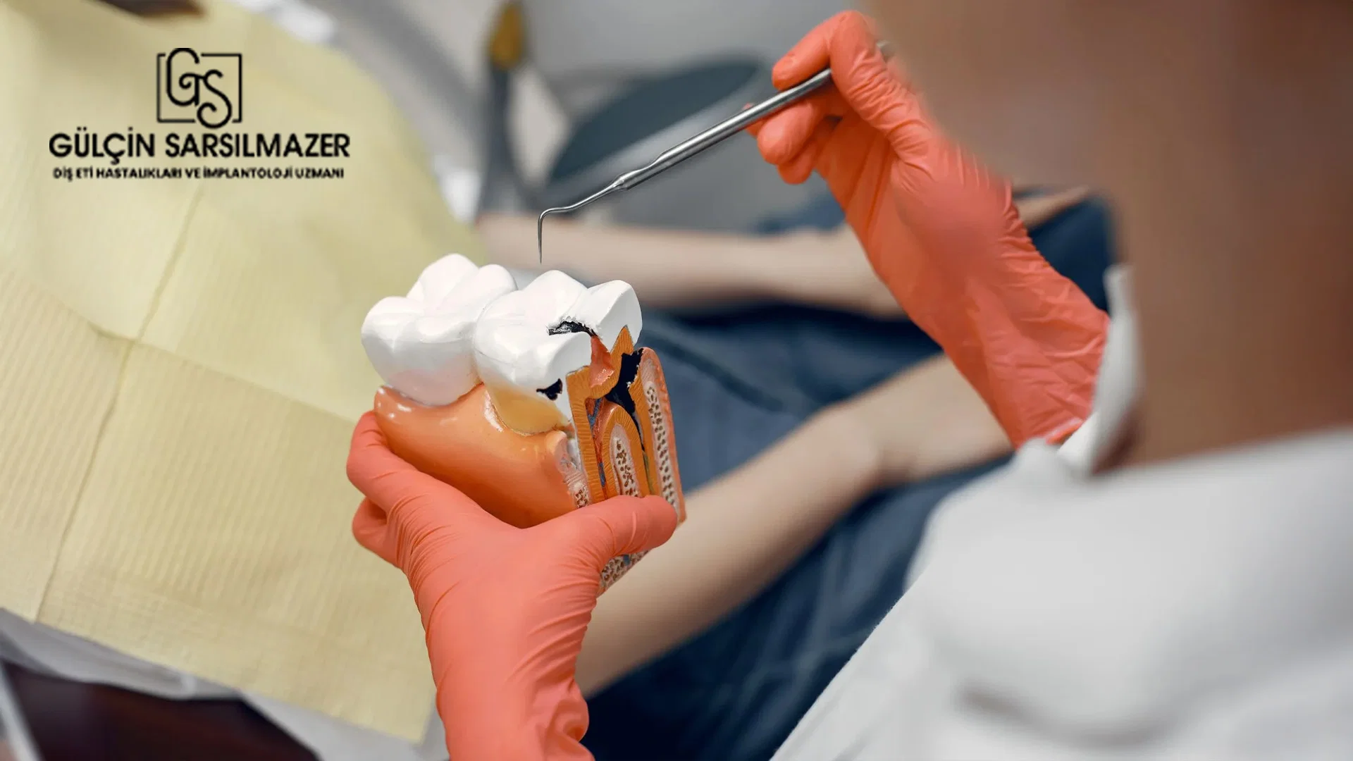 Endodonti Nedir Endodonti Neye Bakar