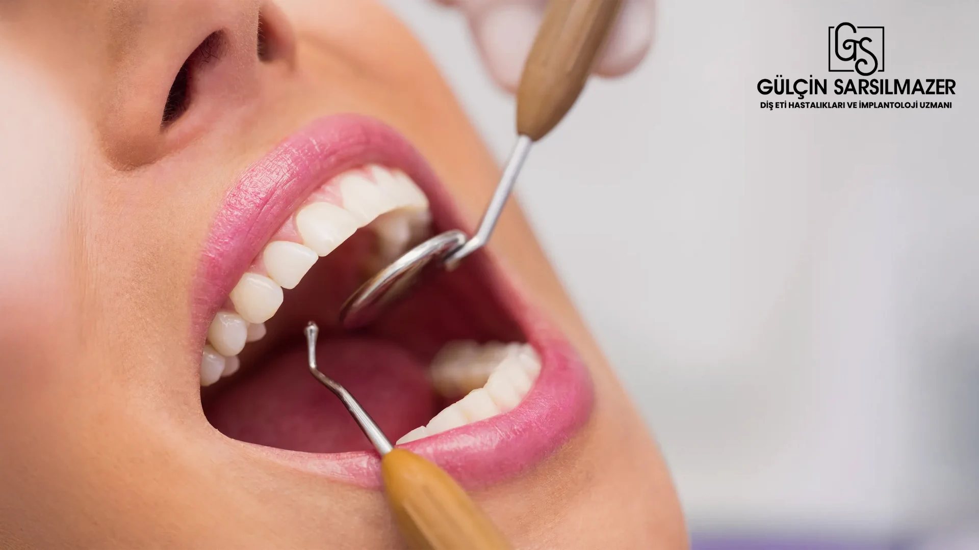 Periodontoloji-Randevusu-Nasıl-Alınır