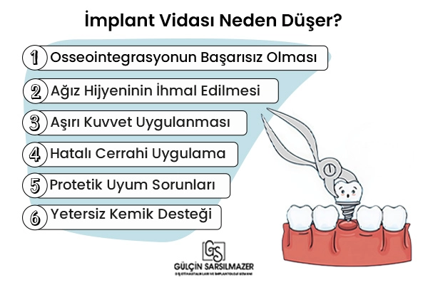 implant-vidası-neden-düşer