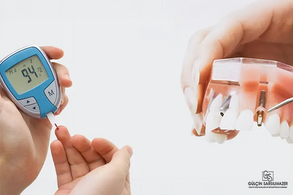 kan şekeri ölçümü ve diş implantı modeli