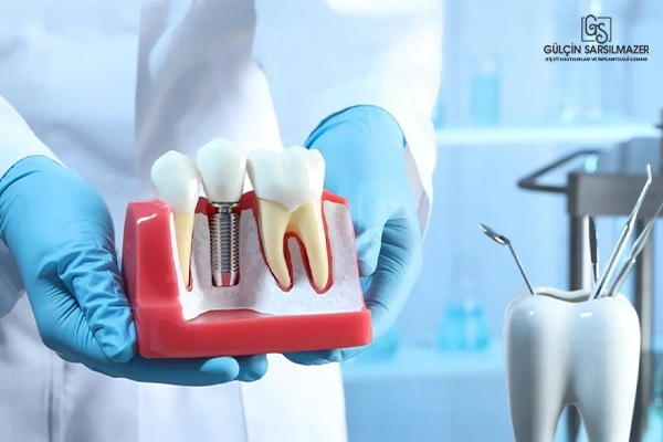 Diş hekimi, elinde diş implantı ve doğal dişleri gösteren anatomik bir model tutuyor