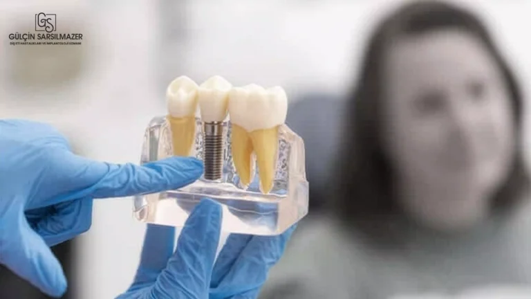 Diş hekimi diş modeli üzerinde tekli dental implant uygulamasını gösteriyor
